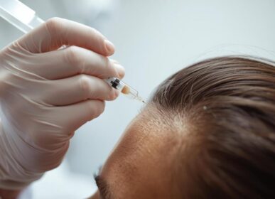 Before After GFC Hair Treatment in Mumbai