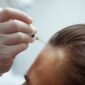 gfc hair treatment borivali 85x85