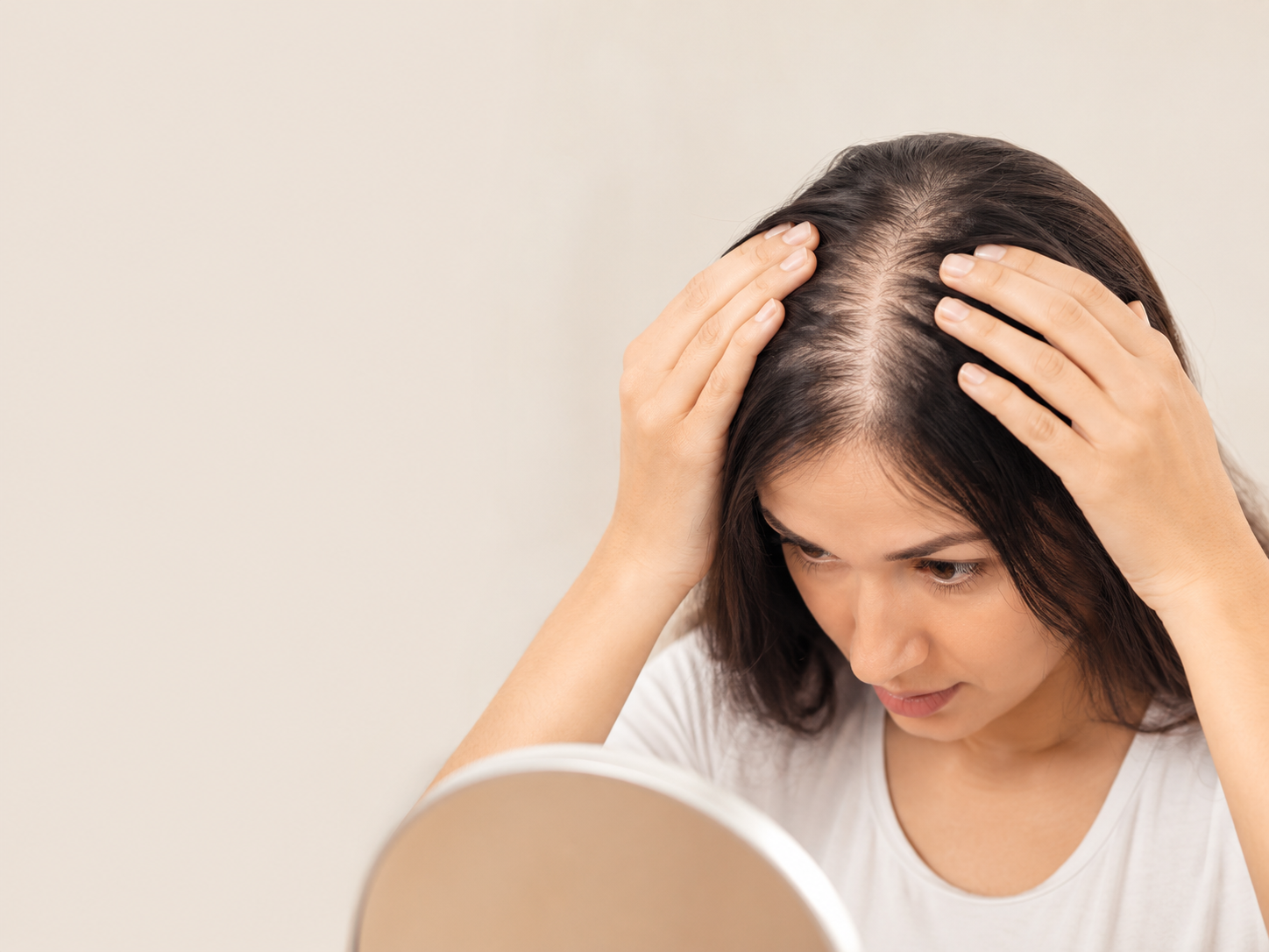 Female Pattern Hair Loss in Women showing widening hair part, reduced hair density, and visible scalp thinning, illustrating early signs of female androgenetic alopecia.