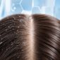 dandruff and scalp health treatment borivali mumbai 85x85