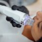microneedling facial treatment clinic mumbai 85x85
