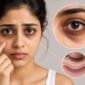 under eye dark circles treatment mumbai dr panktis revive 85x85