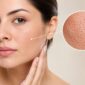 open pores on face enlarged pores treatment 85x85